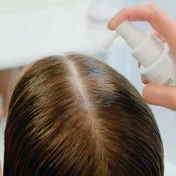 Anti Hair Loss Direct Spray