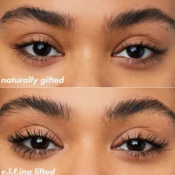 Brow Lift
