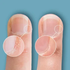 Cuticle Eraser Gentle Exfoliator