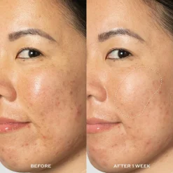 Glow2OH Dark Spot Toner