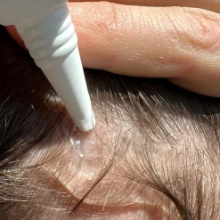 Hair Growth Serum - Hårvækst Serum