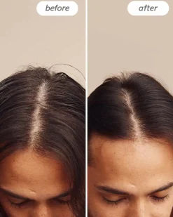 Instant Relief™ Scalp Spray