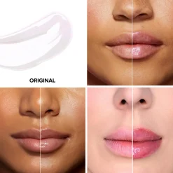 Lip Injection Maximum Dose