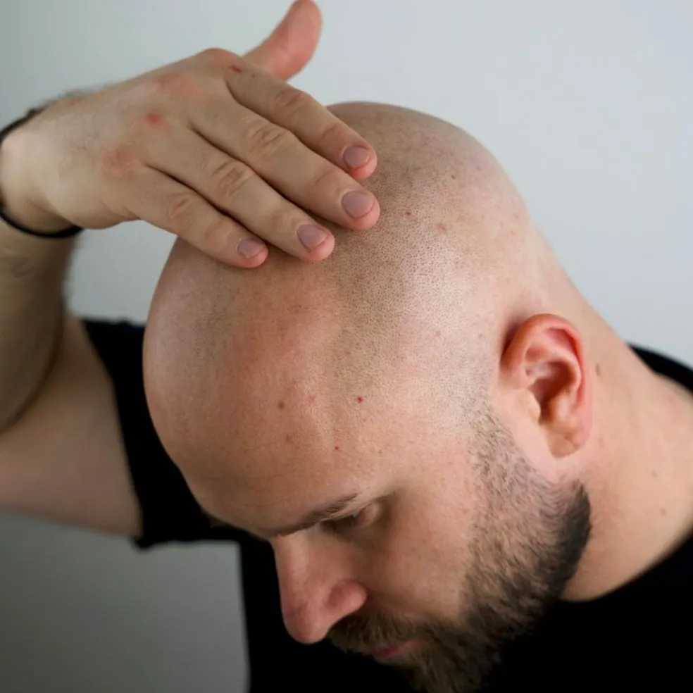 Magic Bald Head & Beard Oil