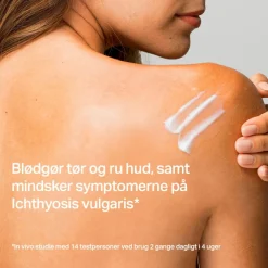 MD22 Carbamide Lotion