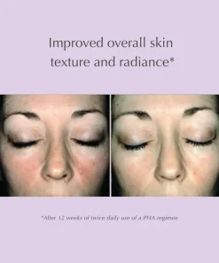 Overnight Transformation Complex