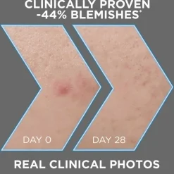 PureActive BHA Charcoal Anti-Imperfection Serum