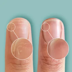 RescueRxx Daily Keratin Treatment