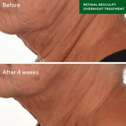 Retinal ReSculpt Overnight Treatment