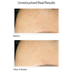 Retinol Youth Renewal Night Cream