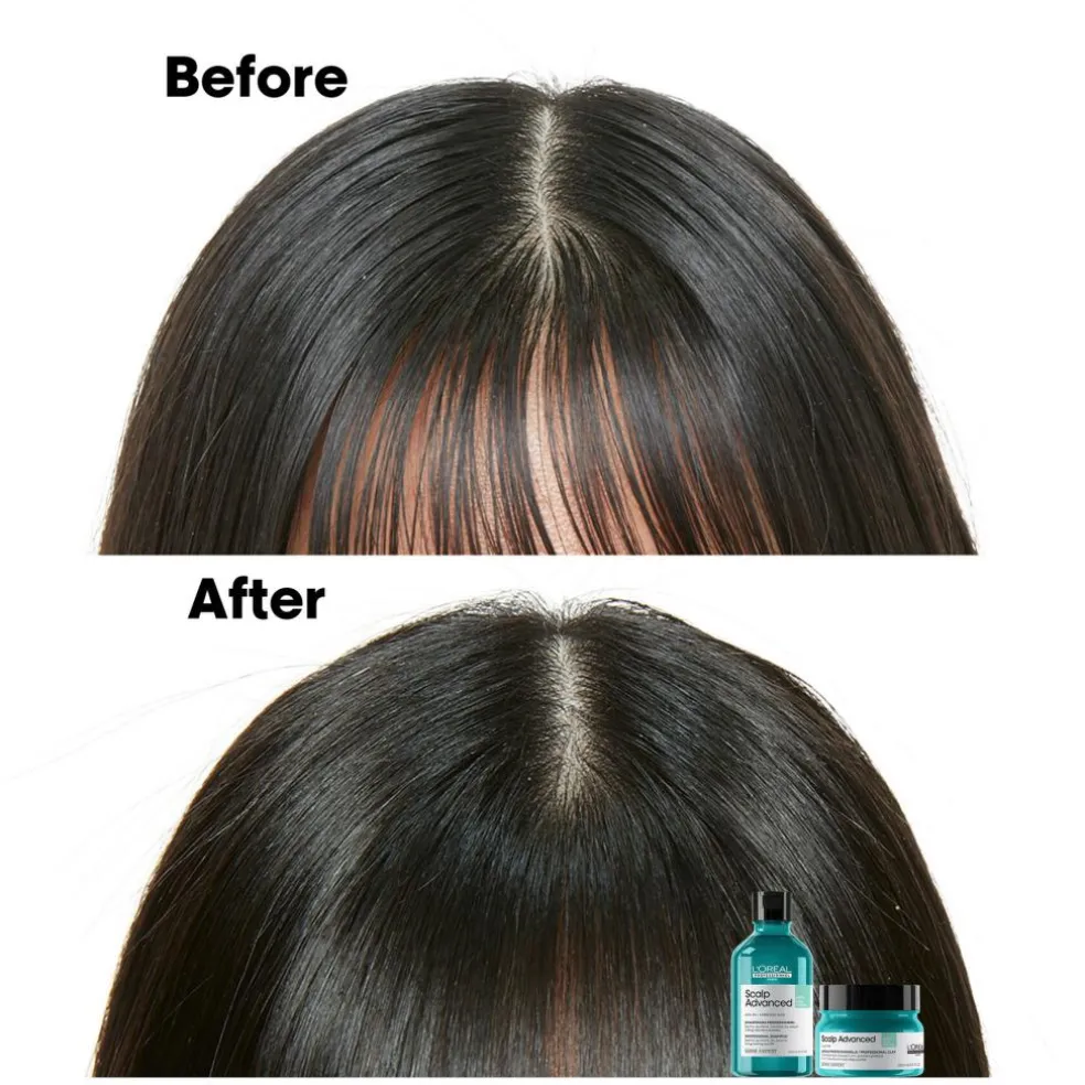 Scalp Advanced Anti-Oiliness 2-In-1 Deep Purifyer Clay