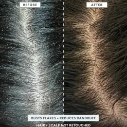 Scalp Revival™ MegaStrength+ Dandruff Relief Shampoo Charcoal + AHA/BHA