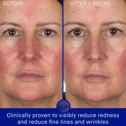 The Hydrogel Face Mask